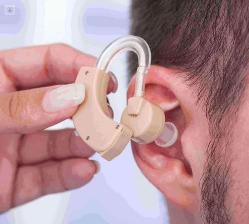 Otosclerosis: Cuando el hueso del oído se endurece (Causas y soluciones)